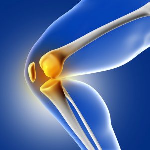 Osteotomy - Flexsion Ortho