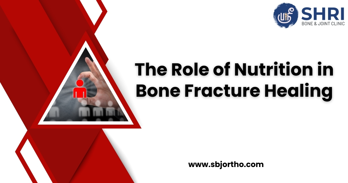 The Role of Nutrition in Bone Fracture Healing- Shri Bone & Joint Clinic