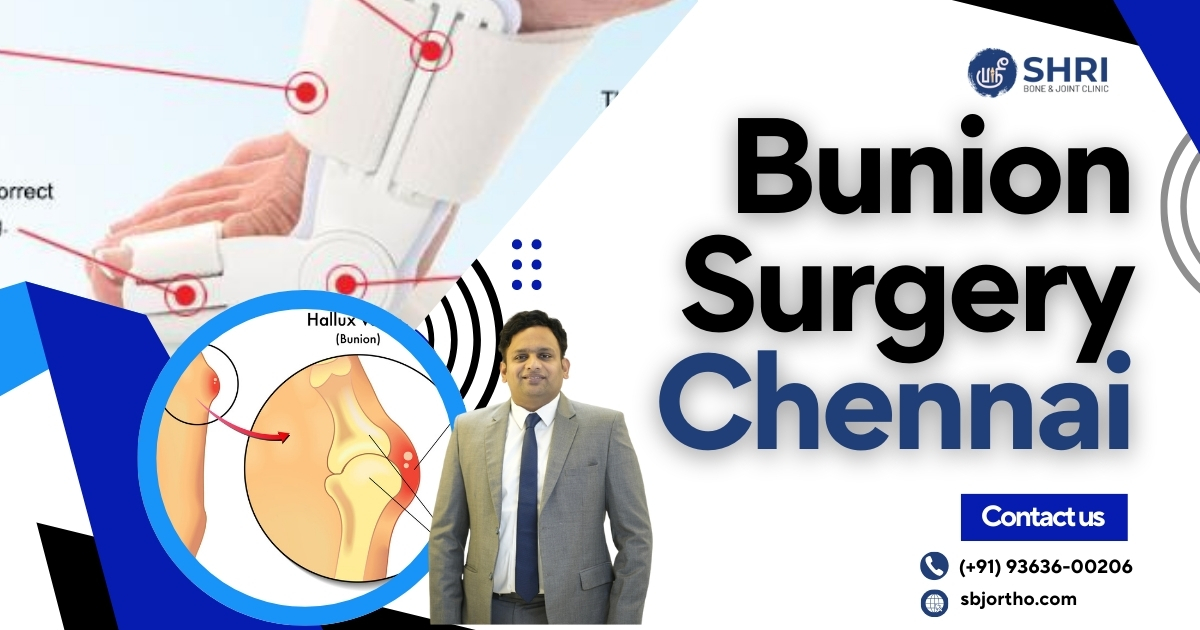 Bunion Surgery Chennai - Shri Bone & Joint Clinic