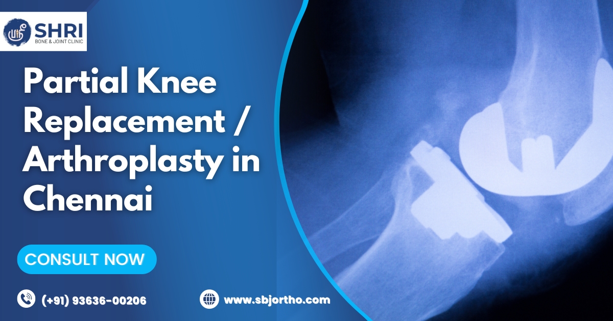 Partial Knee Replacement Arthroplasty in Chennai - Shri Bone & Joint Clinic