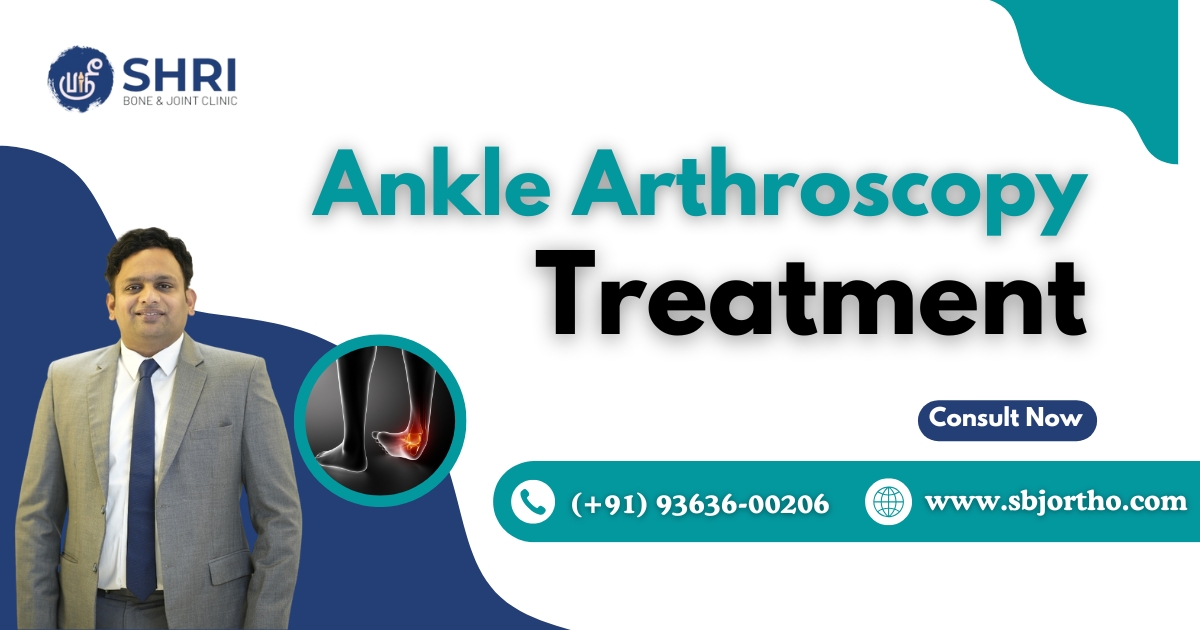 Ankle Arthroscopy - Shri Bone & Joint Clinic