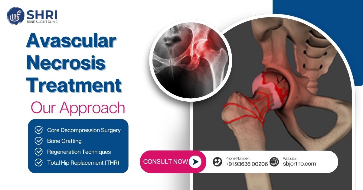 Avascular Necrosis Treatment- Shri Bone & Joint Clinic