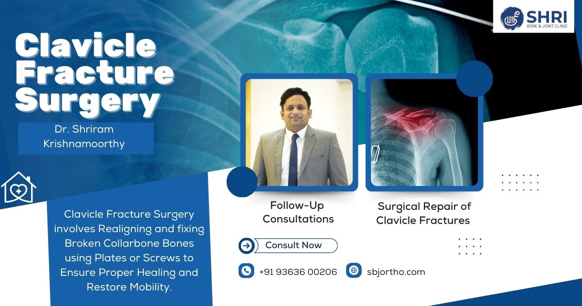 Clavicle Fracture Surgery- Shri Bone & Joint Clinic