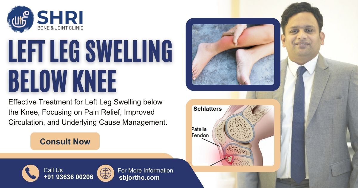 Left Leg Swelling Below Knee- Shri Bone & Joint Clinic