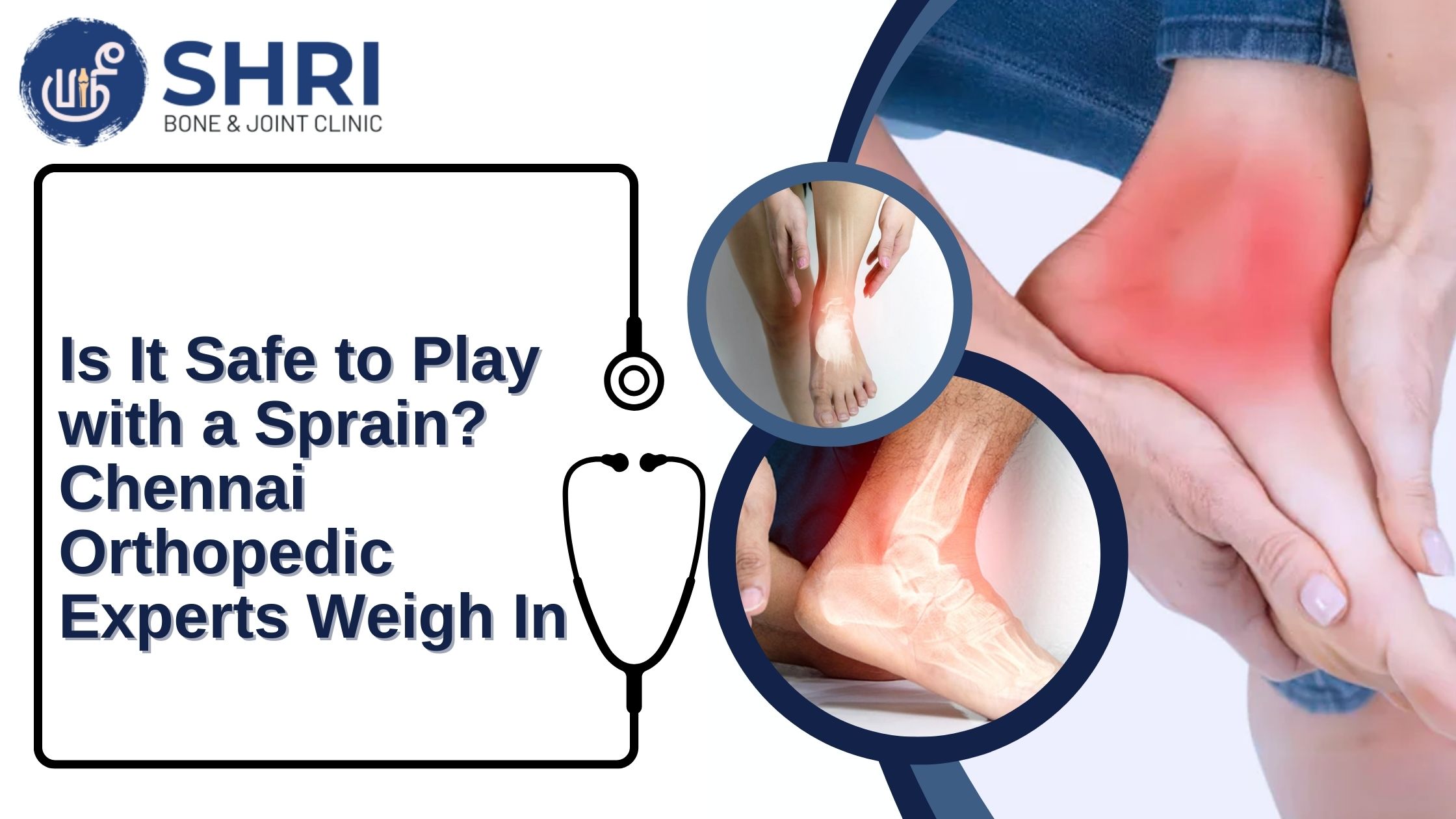 Is It Safe to Play with a Sprain? Chennai Orthopedic Experts Weigh In