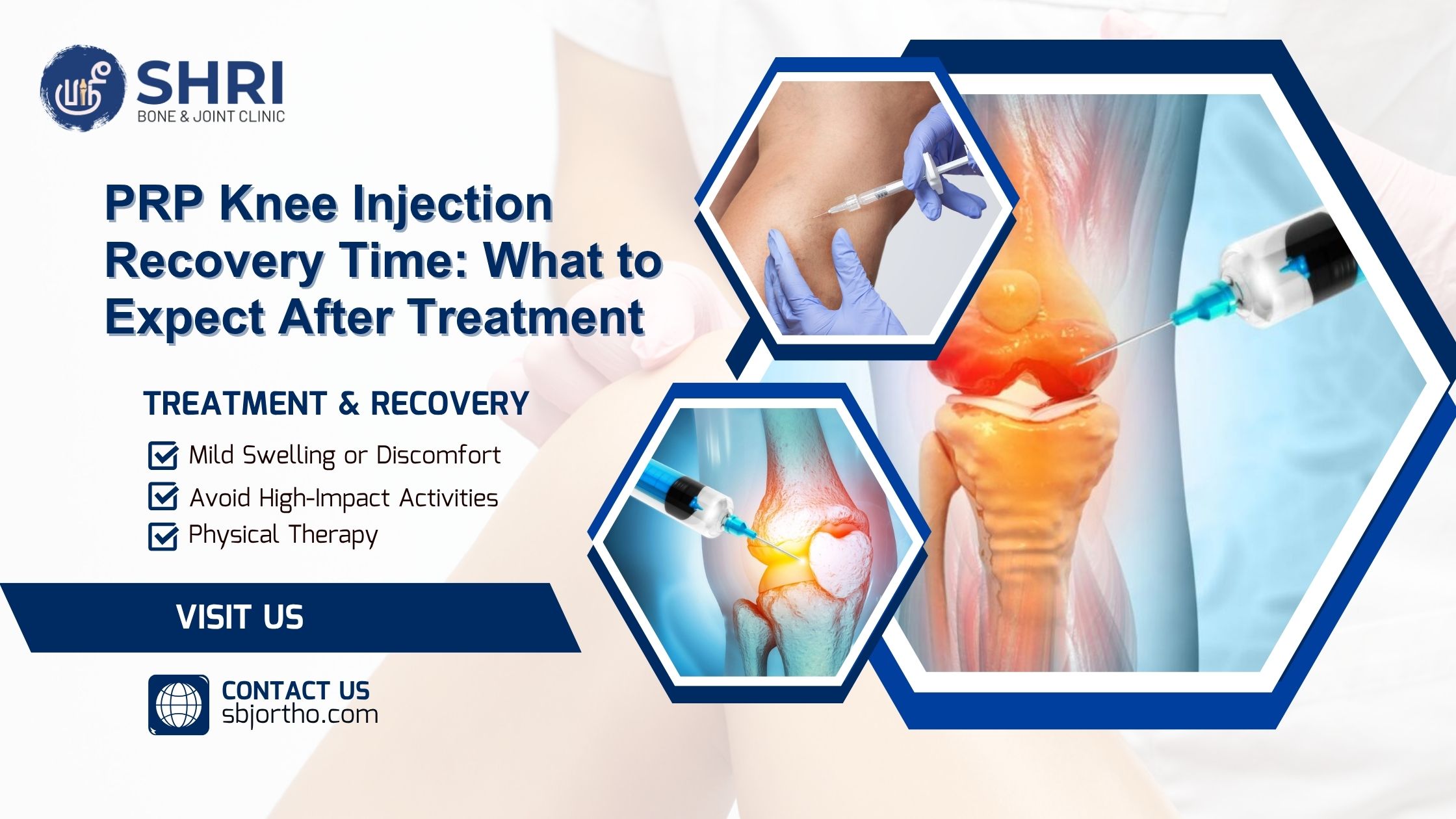 PRP Knee Injection Recovery Time: What to Expect After Treatment