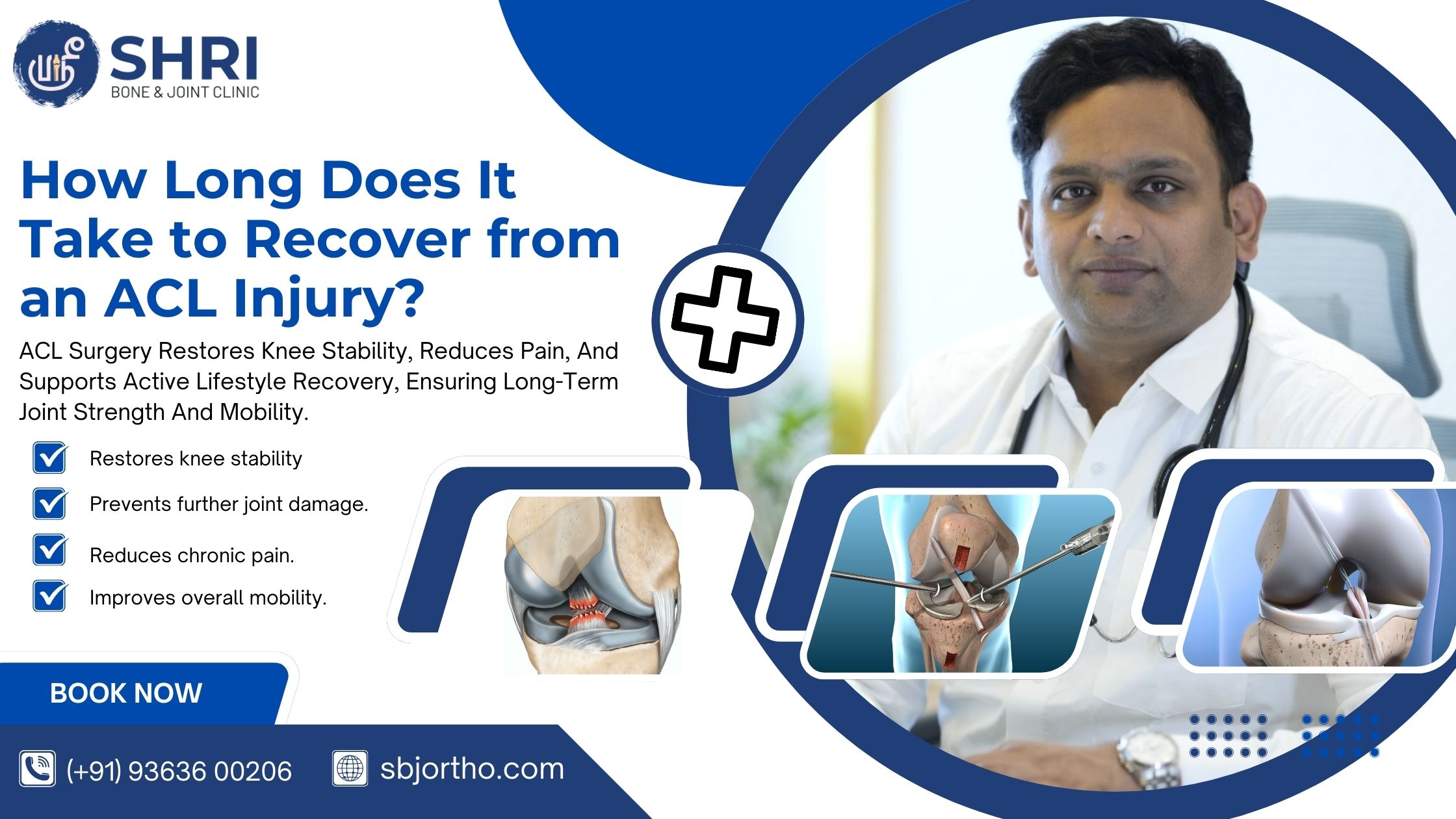 How Long Does It Take to Recover from an ACL Injury?