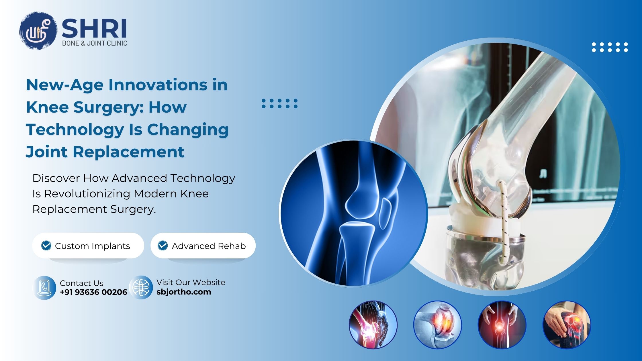 New-Age Innovations in Knee Surgery: How Technology Is Changing Joint Replacement