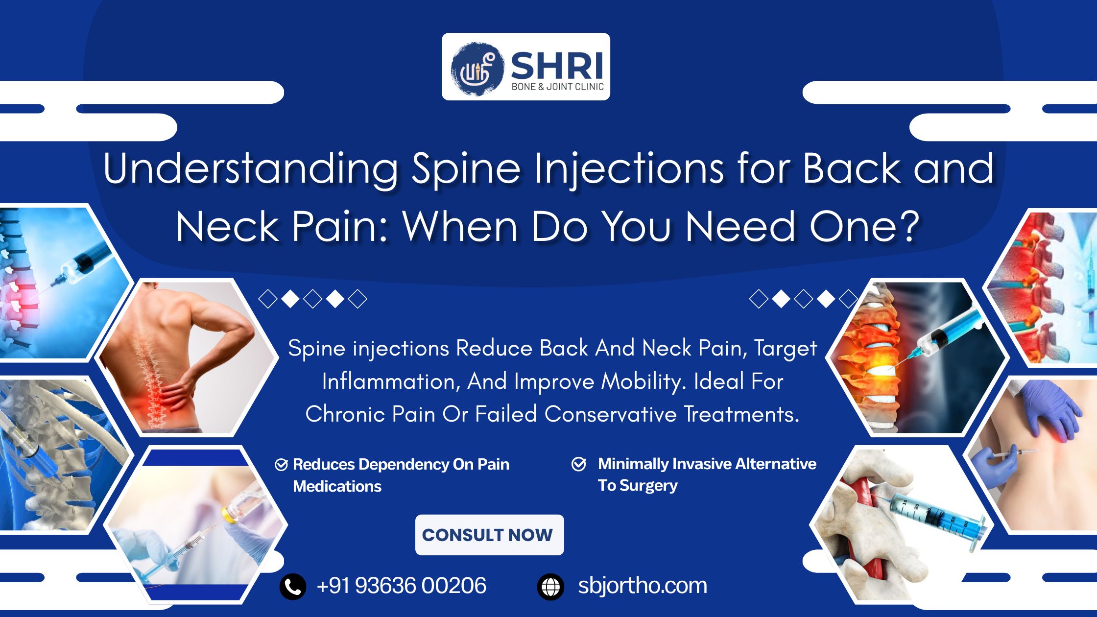 Understanding Spine Injections for Back and Neck Pain: When Do You Need One?