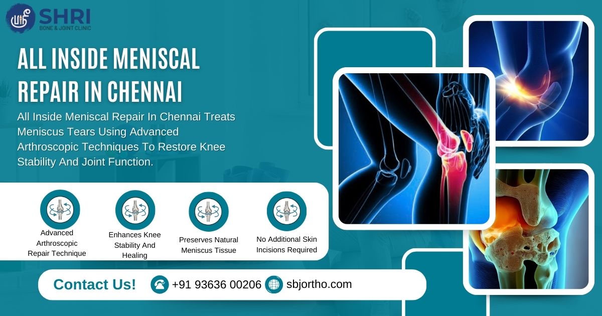 All Inside Meniscal Repair in Chennai