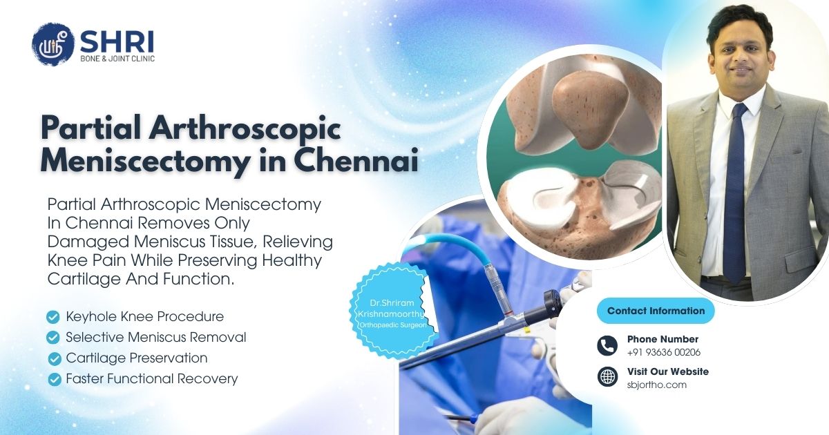 Partial Arthroscopic Meniscectomy in Chennai