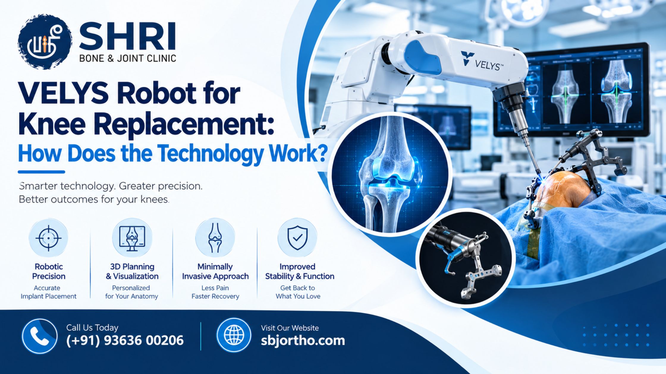 VELYS Robot for Knee Replacement: How Does the Technology Work?