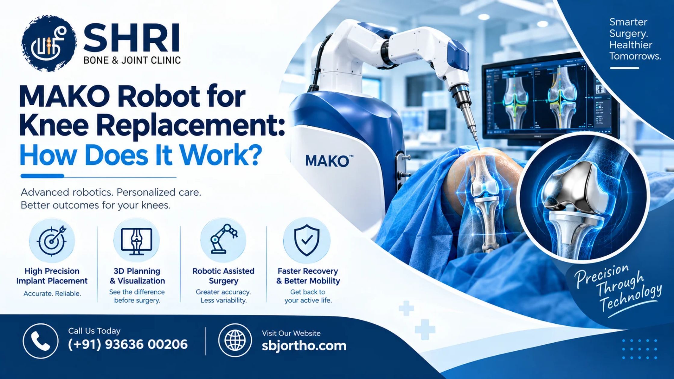 MAKO Robot for Knee Replacement: How It Works