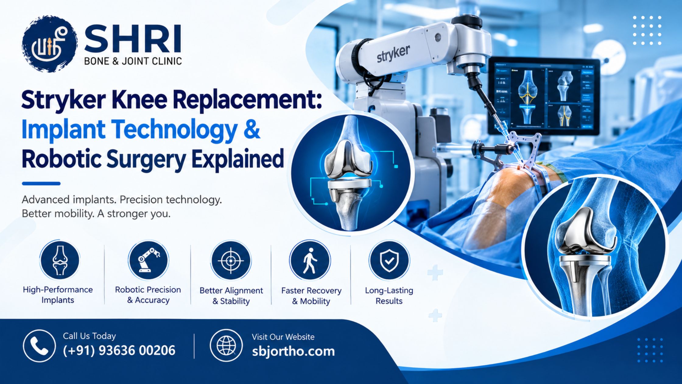Stryker Knee Replacement: Implant Technology & Robotic Surgery Explained